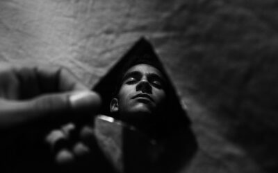 Body Dysmorphic Disorder (BDD)